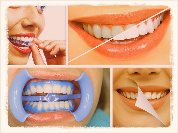 о отбеливание зубов в домашних